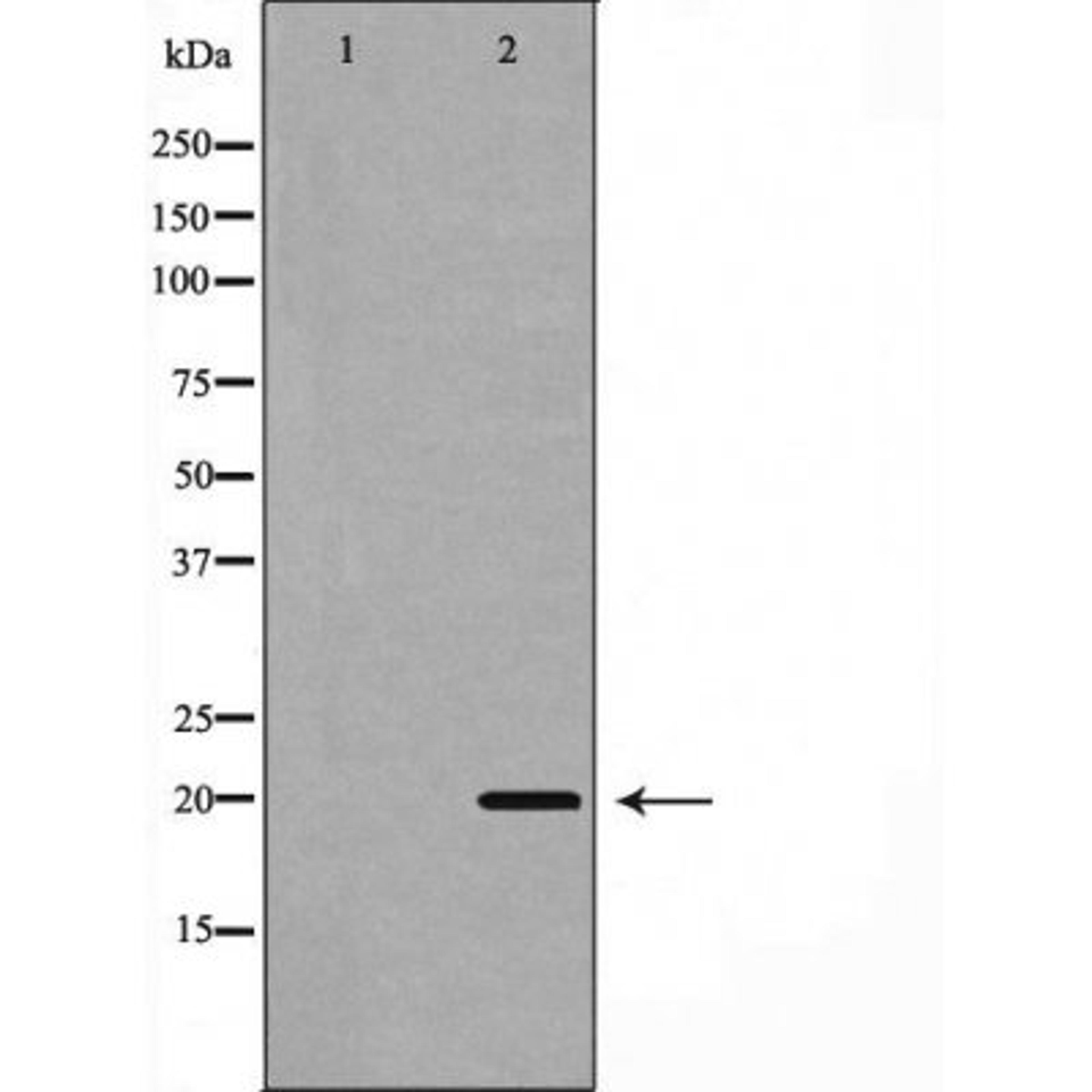 Western blot analysis of 293 cells using BBC3(PUMA) antibody