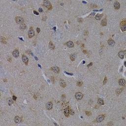 Immunohistochemical staining of rat brain tissue using POLR2L antibody (dilution of 1:200)