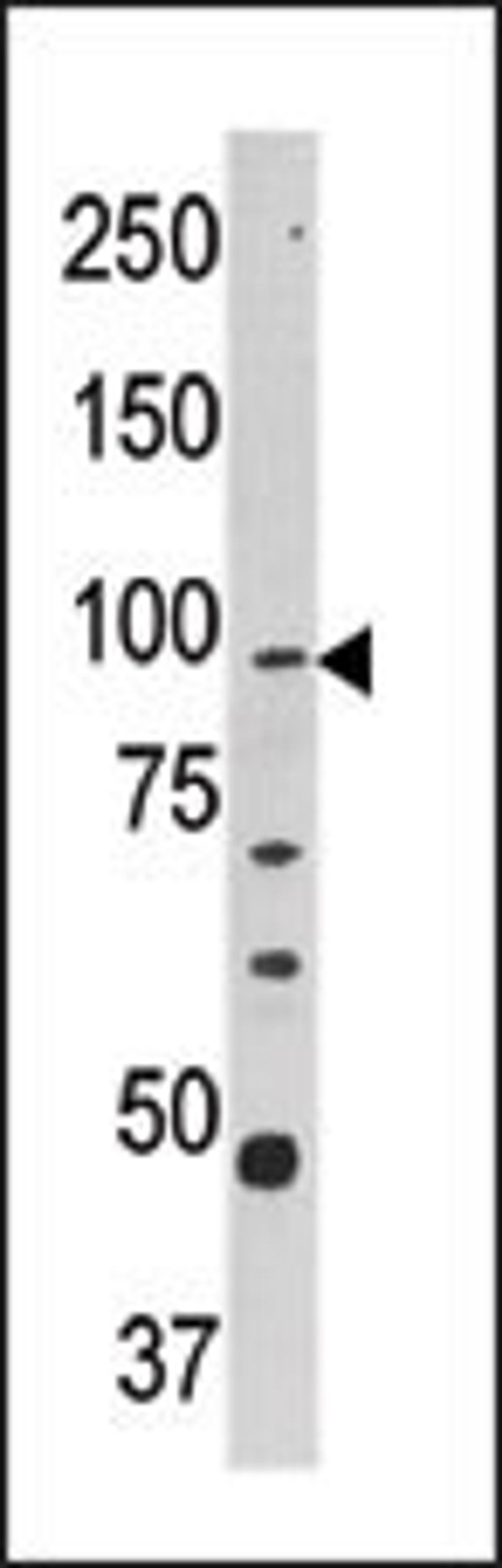 Western blot analysis of anti-CPT1A Pab in Y79 cell line lysate (35ug/lane).