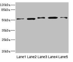 Western blot. All lanes: NFKBIE antibody at 4.17ug/ml. Lane 1: Mouse liver tissue. Lane 2: Hela whole cell lysate. Lane 3: Jurkat whole cell lysate. Lane 4: A375 whole cell lysate. Lane 5: 293T whole cell lysate. Secondary. Goat polyclonal to rabbit IgG at 1/10000 dilution. Predicted band size: 53 kDa. Observed band size: 53 kDa.