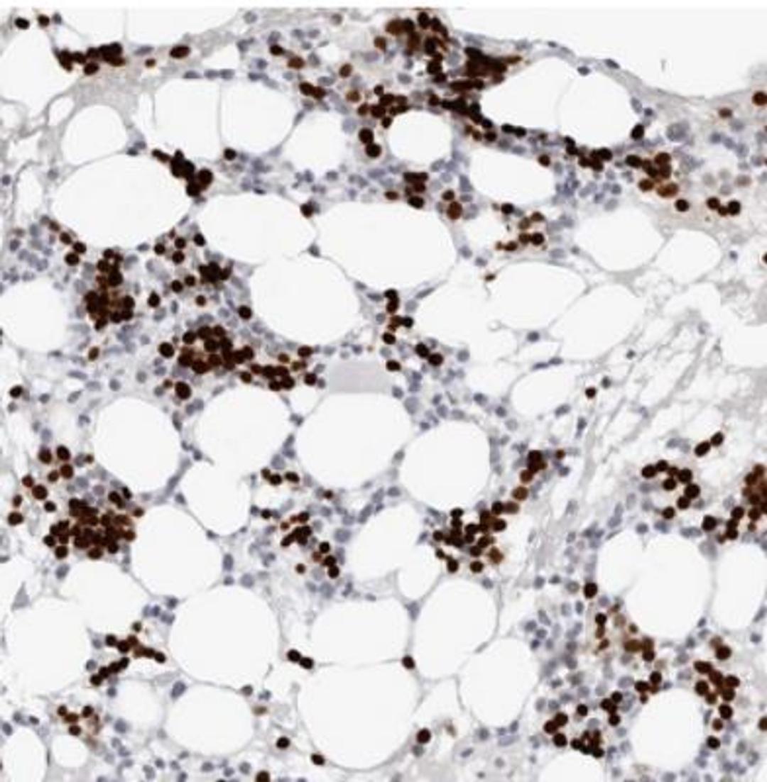 Immunohistochemistry: Endothelin 2 Antibody [NBP1-87942] - Staining of human bone marrow shows strong nuclear positivity in bone marrow poietic cells.