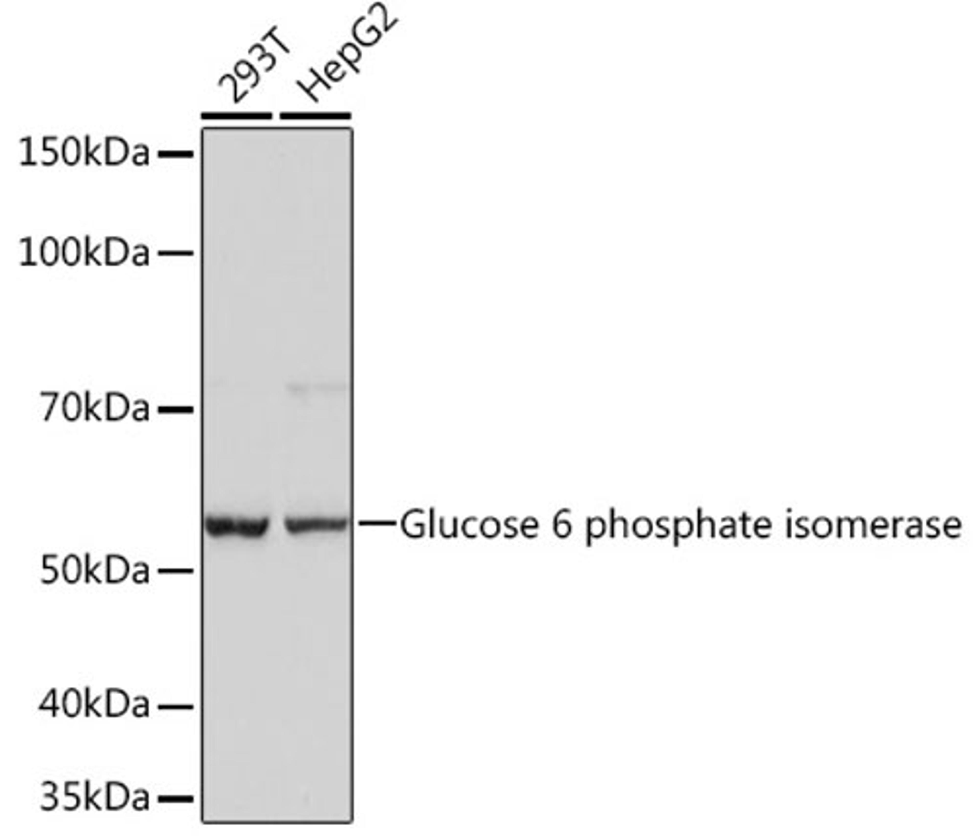 Western blot - Glucose 6 phosphate isomerase Rabbit mAb (A4401)