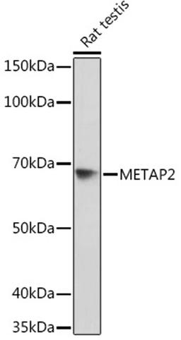 Western blot - METAP2 Rabbit mAb (A3465)