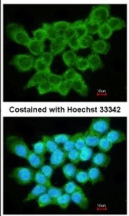 Immunocytochemistry/Immunofluorescence: FRAT1 Antibody [NBP1-31213] - Analysis of methanol-fixed A431, using antibody at 1:200 dilution.