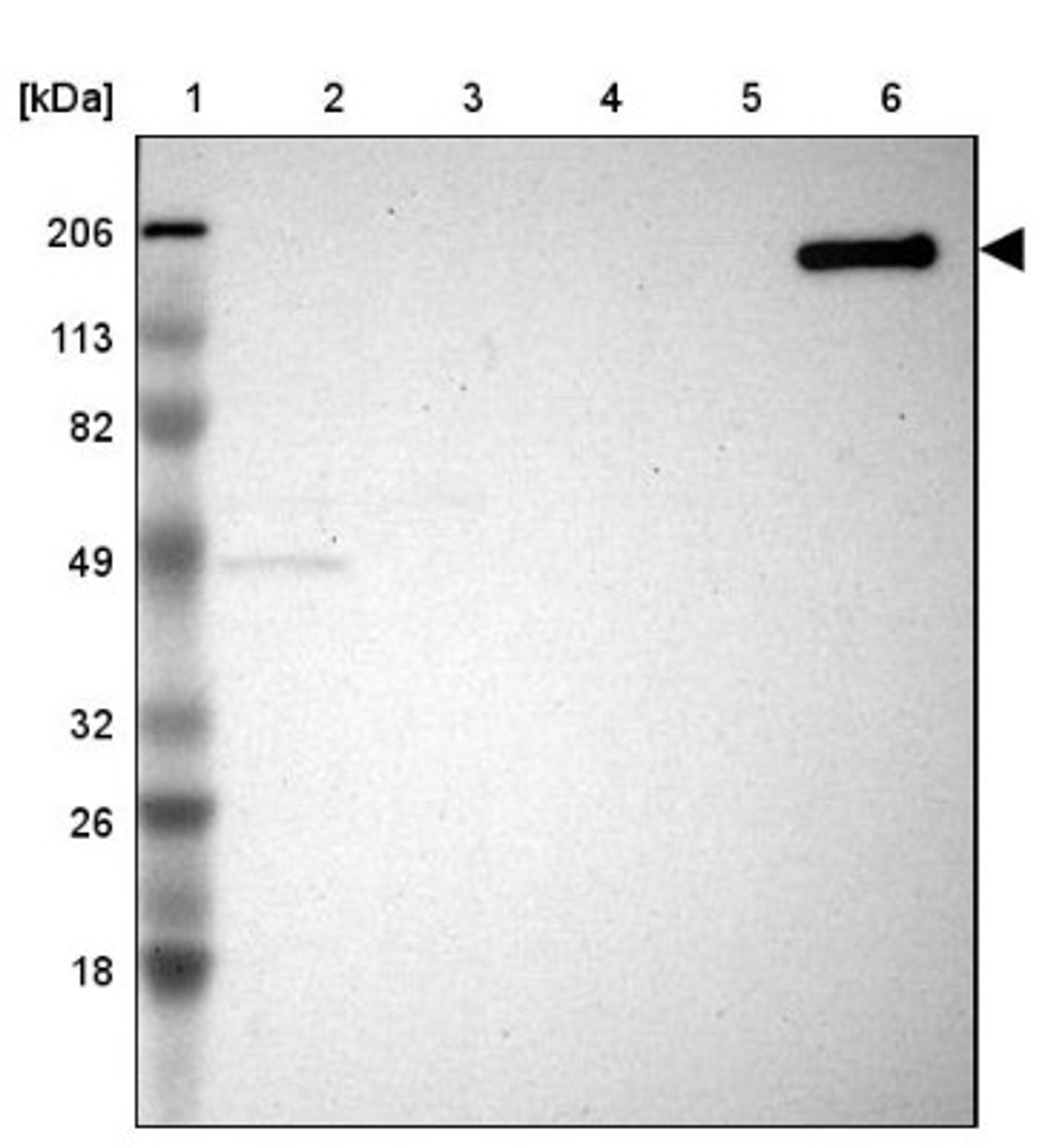 Western Blot: Myomesin 2 Antibody [NBP1-87496] - Lane 1: Marker [kDa] 206, 113, 82, 49, 32, 26, 18<br/>Lane 2: Human cell line RT-4<br/>Lane 3: Human cell line U-251MG sp<br/>Lane 4: Human cell line A-431<br/>Lane 5: Human liver tissue<br/>Lane 6: Human tonsil tissue