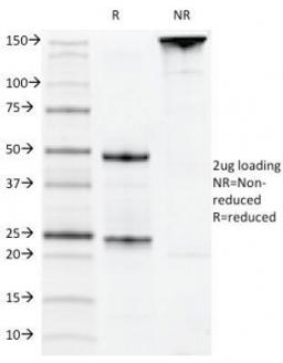 SDS-PAGE Analysis of Purified, BSA-Free CD22 Antibody (clone MYG13). Confirmation of Integrity and Purity of the Antibody.