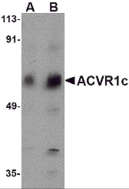 Western blot analysis of ACVR1C in human placenta tissue lysate with ACVR1C antibody at (A) 1 and (B) 2 &#956;g/mL.