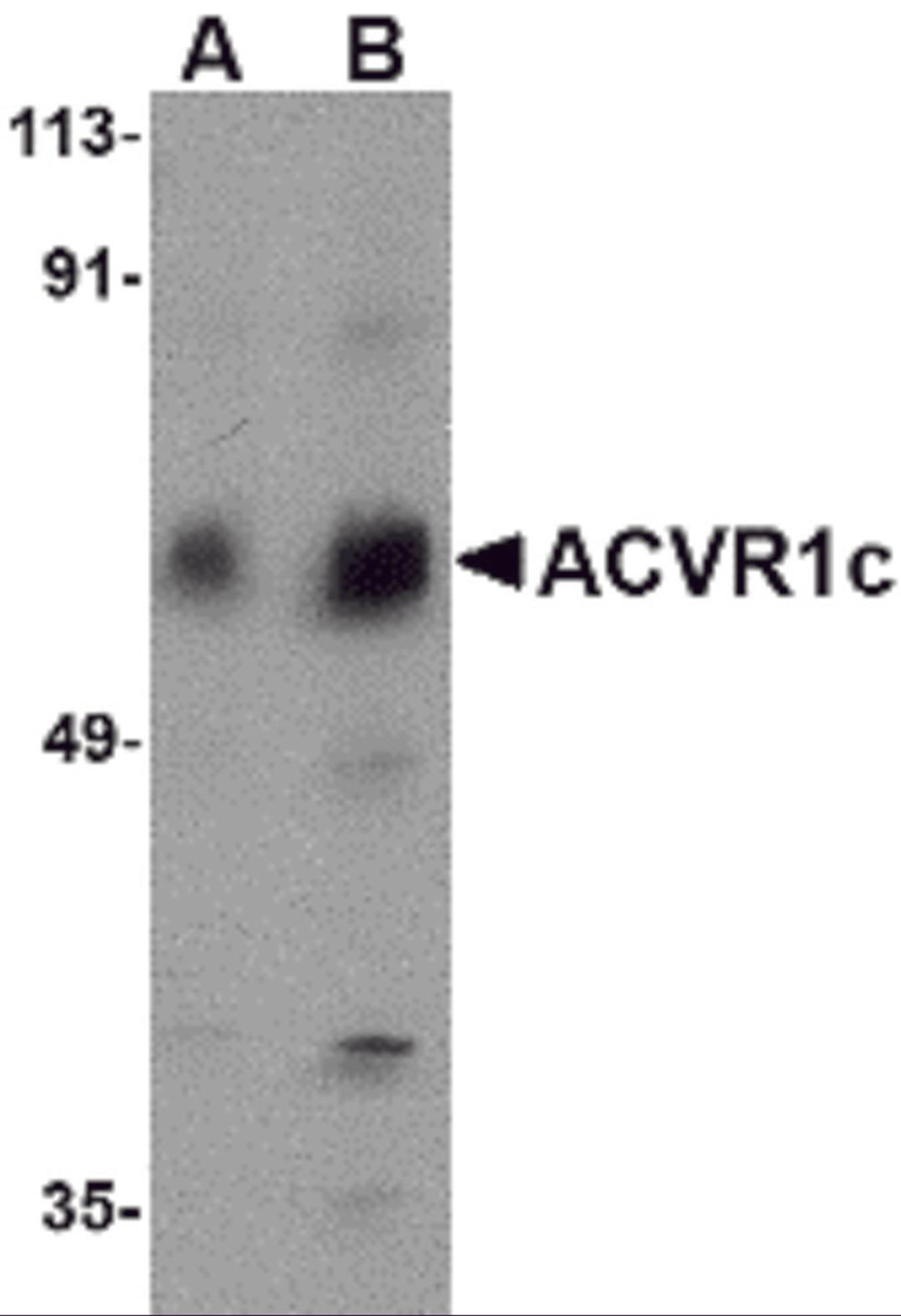 Western blot analysis of ACVR1C in human placenta tissue lysate with ACVR1C antibody at (A) 1 and (B) 2 μg/mL.