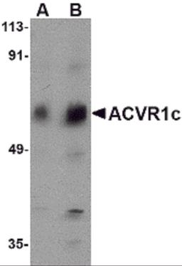 Western blot analysis of ACVR1C in human placenta tissue lysate with ACVR1C antibody at (A) 1 and (B) 2 μg/mL.