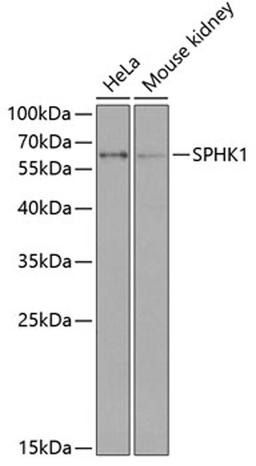 Western blot - SPHK1 antibody (A0660)