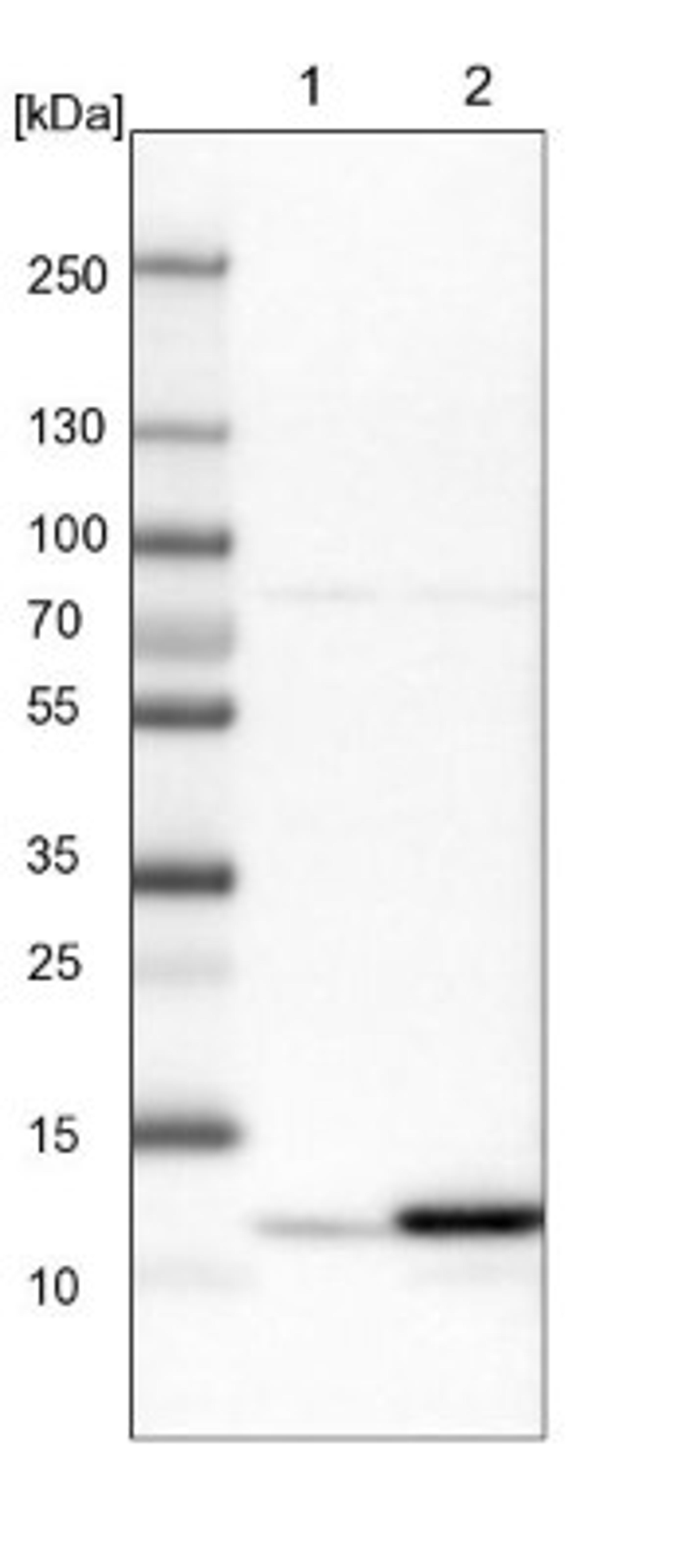 Western Blot: HRSP12 Antibody [NBP1-82452] - Lane 1: Mouse liver tissue lysate<br/>Lane 2: Rat liver tissue lysate