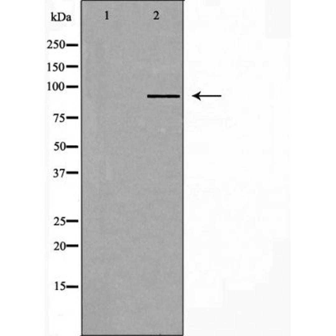 Western blot analysis of Hela cells using RPTN antibody