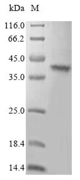 (Tris-Glycine gel) Discontinuous SDS-PAGE (reduced) with 5% enrichment gel and 15% separation gel.