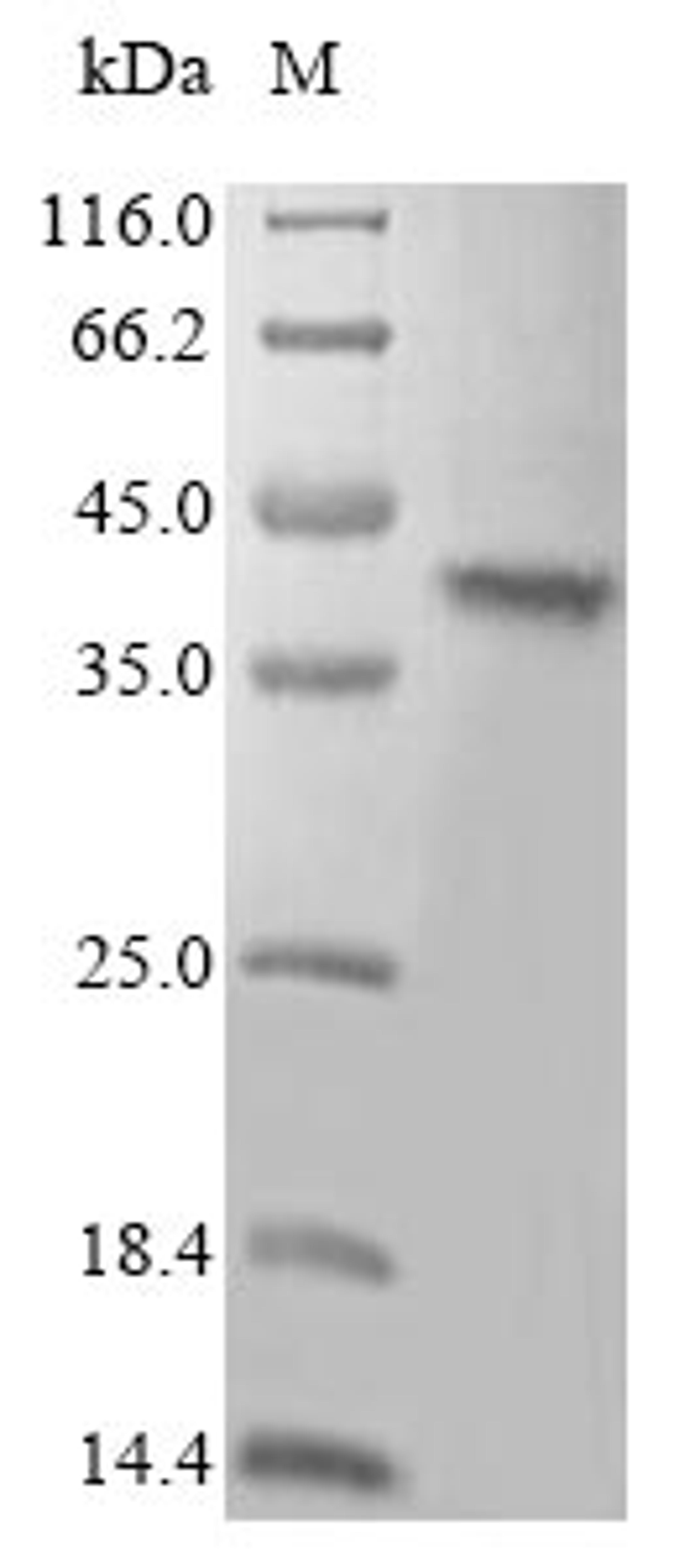 (Tris-Glycine gel) Discontinuous SDS-PAGE (reduced) with 5% enrichment gel and 15% separation gel.