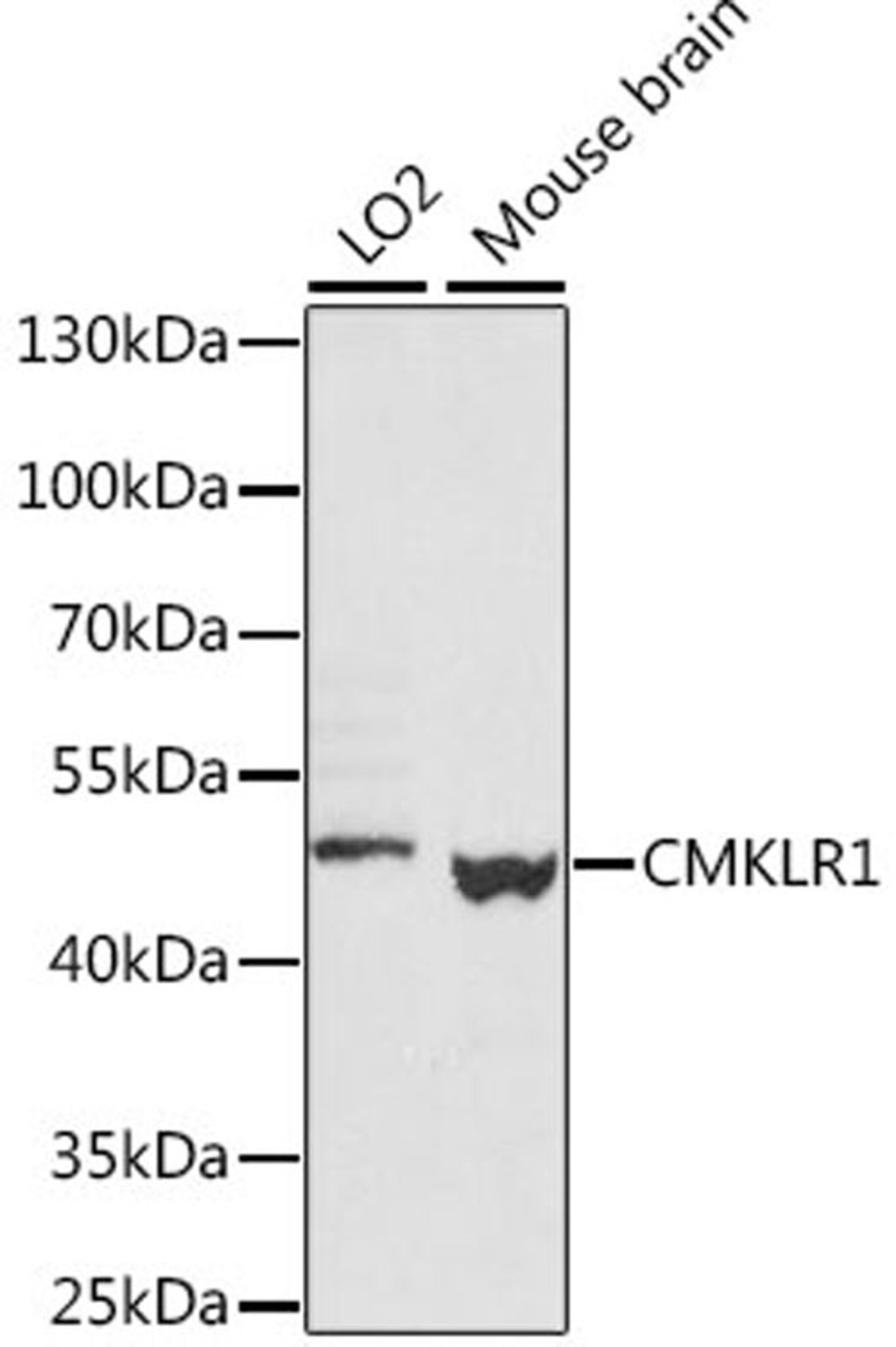 Western blot - CMKLR1 antibody (A15237)