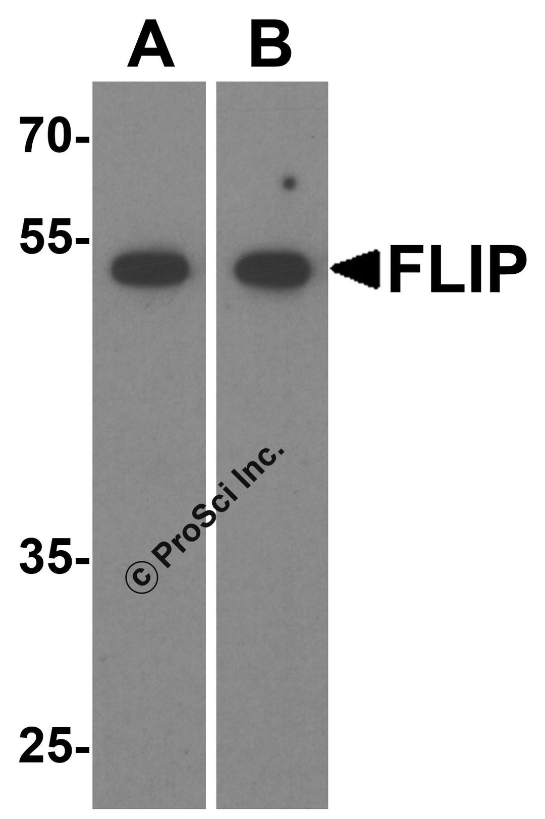 Western blot analysis of FLIP in (A) HeLa cell and (B) mouse liver tissue lysate with FLIP antibody at 1 μg/ml.