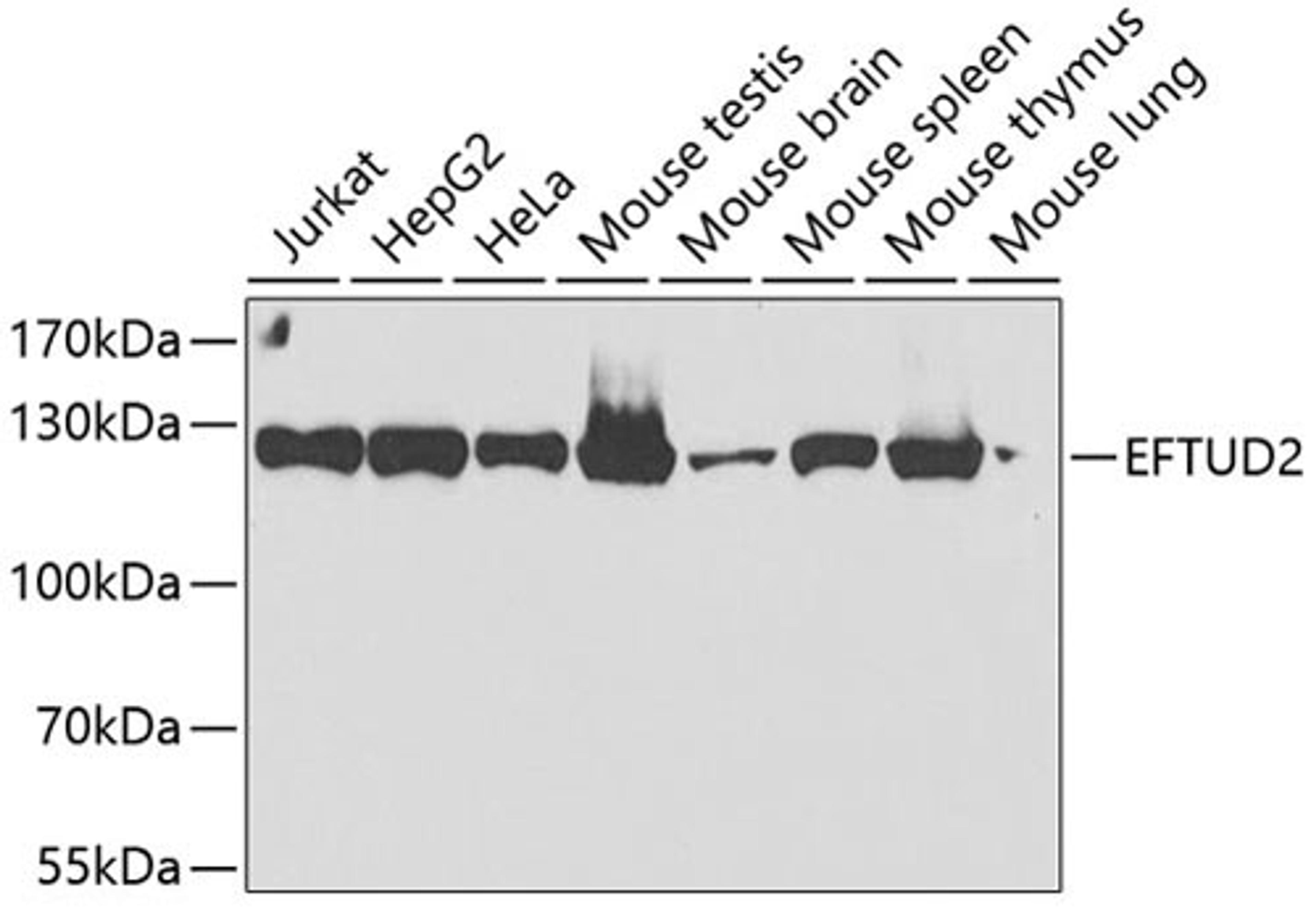 Western blot - EFTUD2 antibody (A7040)