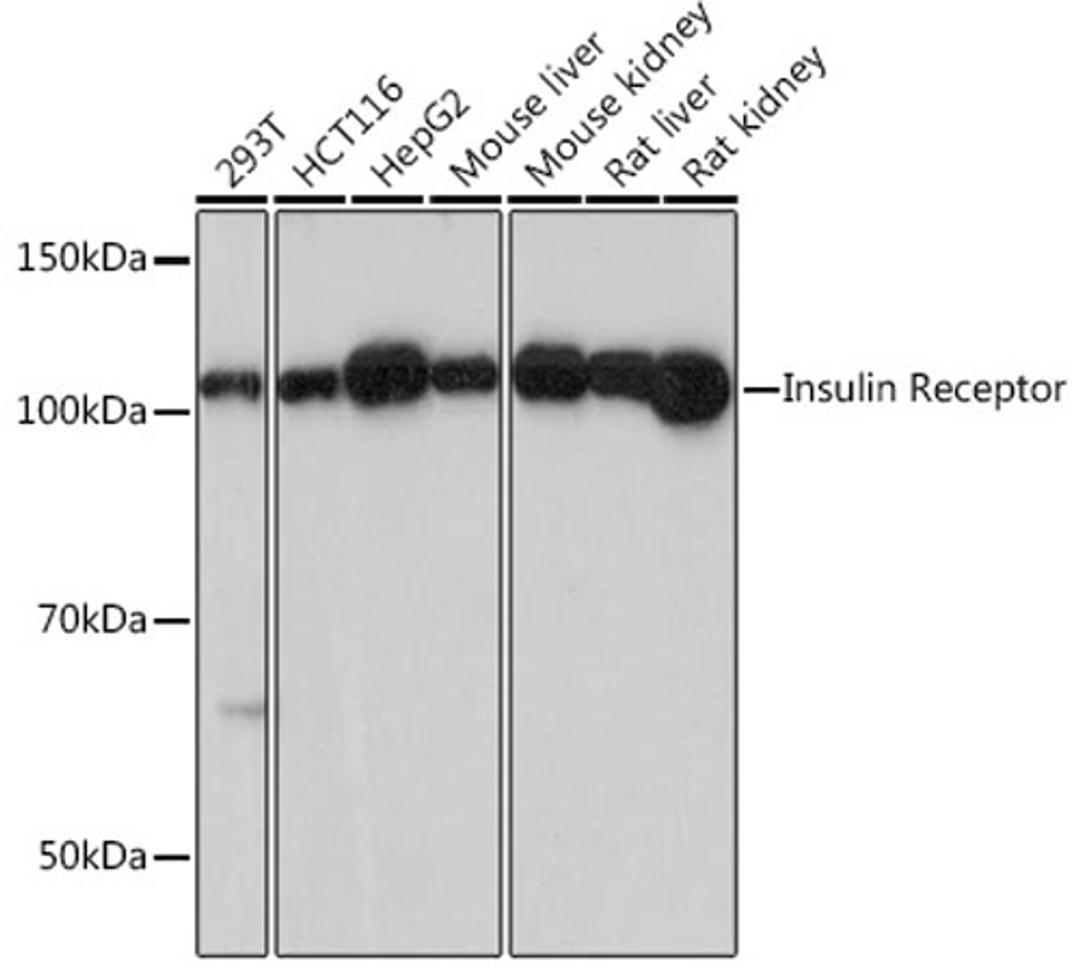 Western blot - Insulin Receptor antibody (A19067)