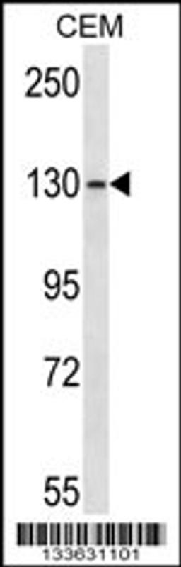 Western blot analysis in CEM cell line lysates (35ug/lane).