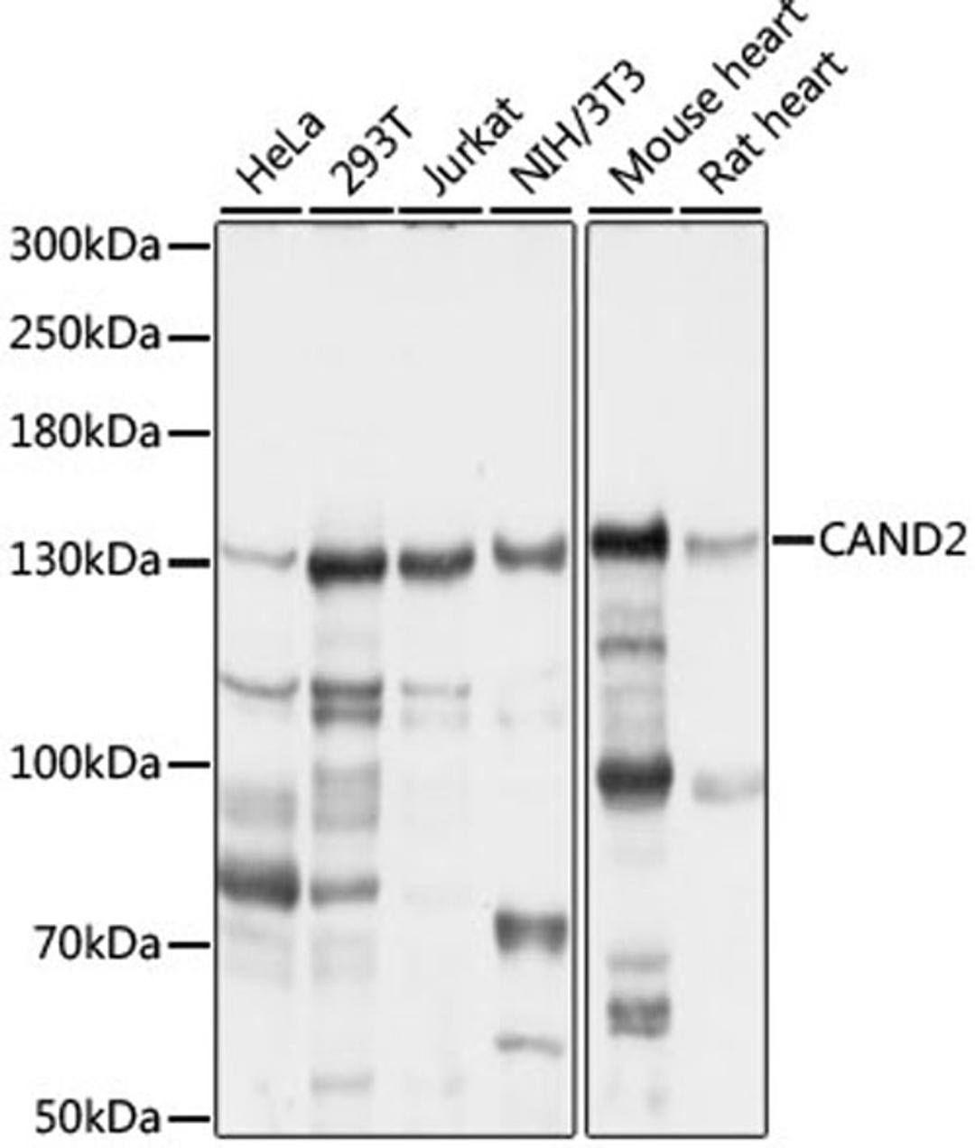 Western blot - CAND2 antibody (A16500)