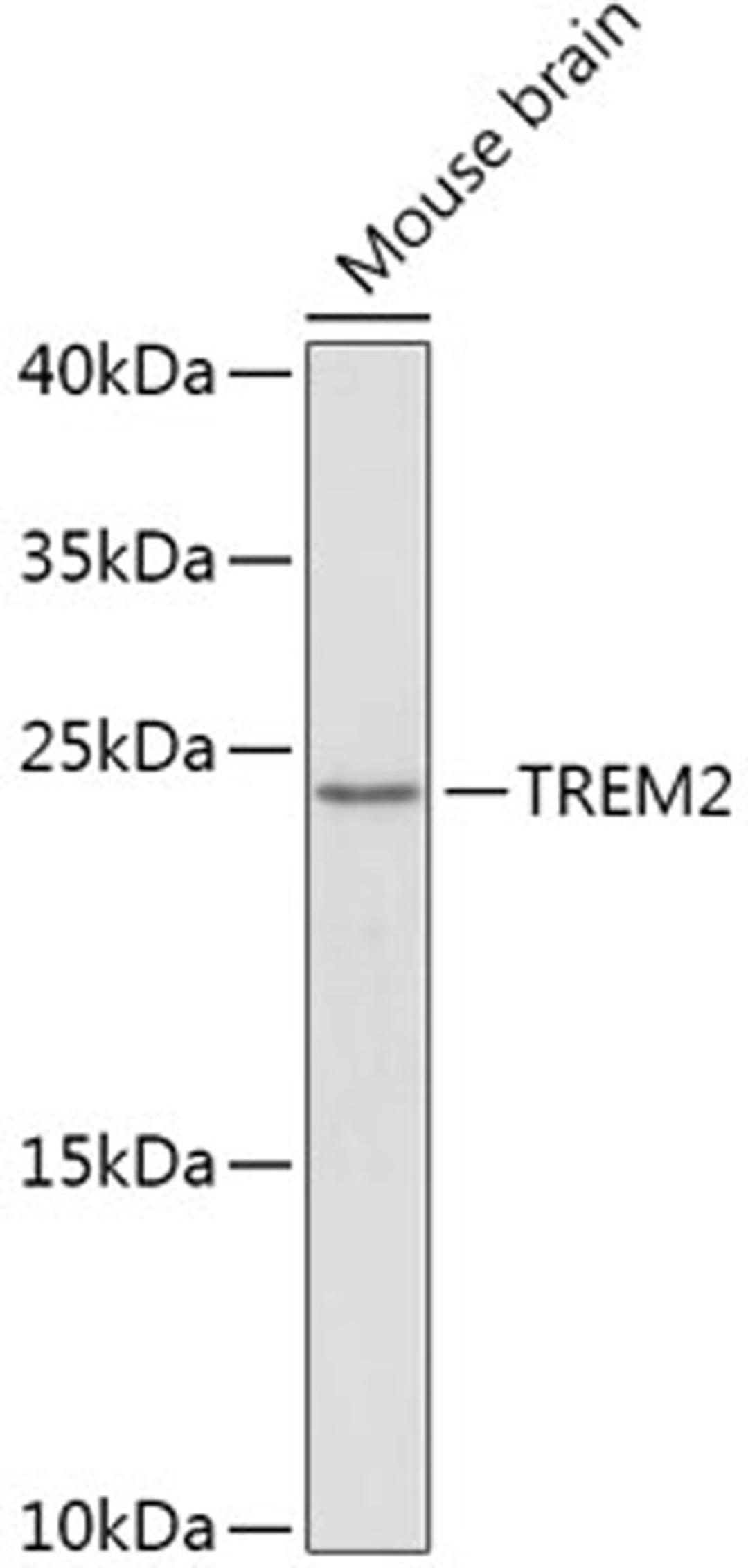 Western blot - TREM2 antibody (A10482)