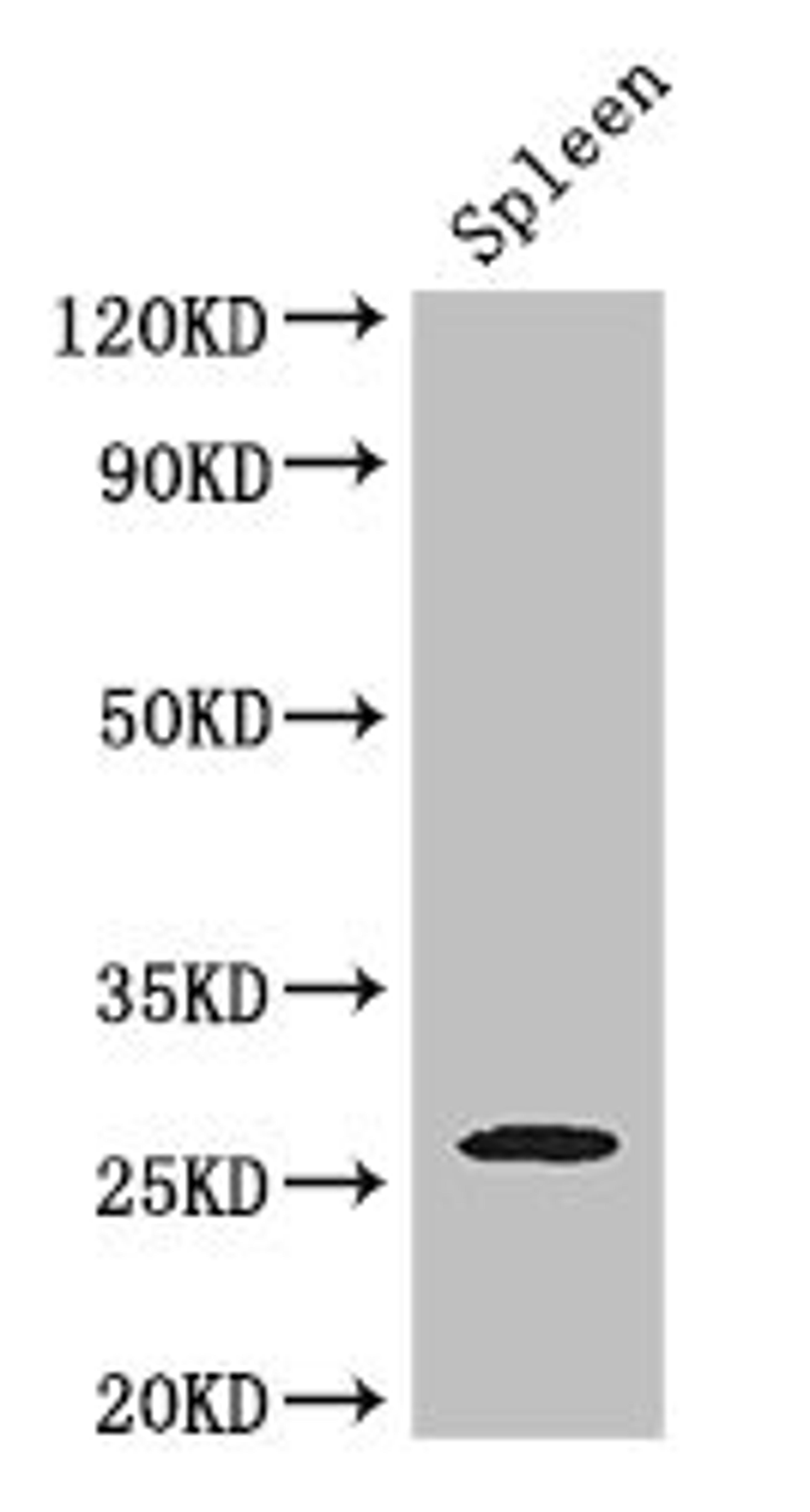 Western Blot. Positive WB detected in: Mouse spleen tissue. All lanes: ZC4H2 antibody at 3ug/ml. Secondary. Goat polyclonal to rabbit IgG at 1/50000 dilution. Predicted band size: 27, 16, 24, 21, 26 kDa. Observed band size: 27 kDa.