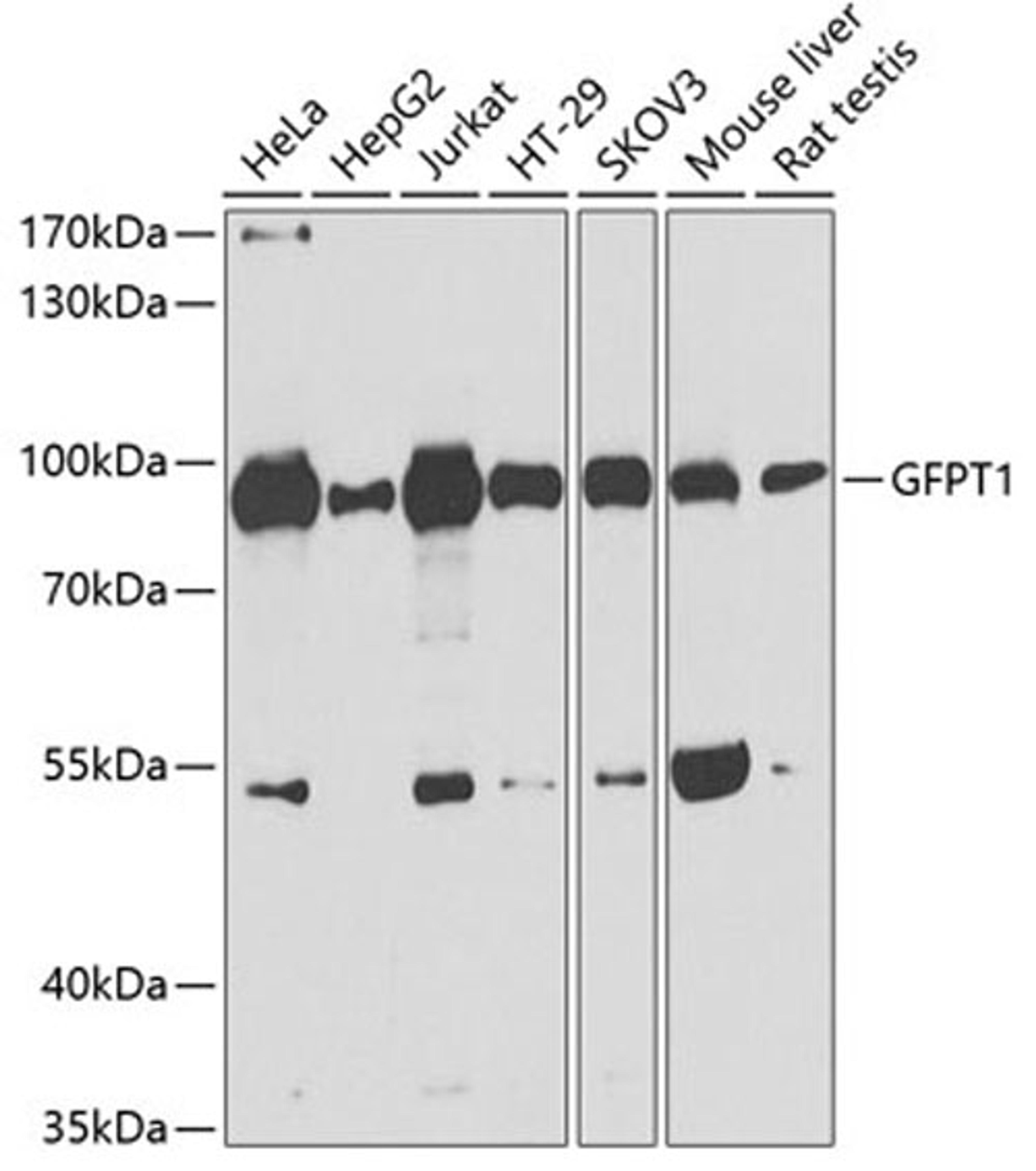 Western blot - GFPT1 antibody (A3882)