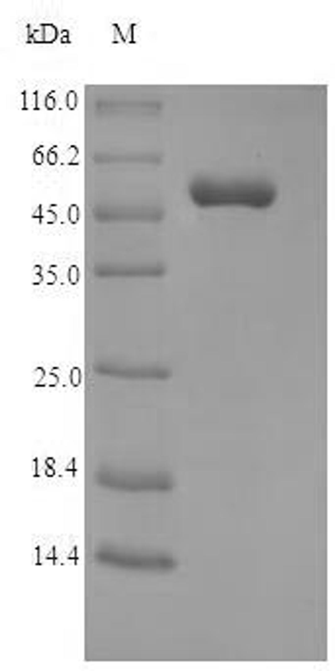 (Tris-Glycine gel) Discontinuous SDS-PAGE (reduced) with 5% enrichment gel and 15% separation gel.