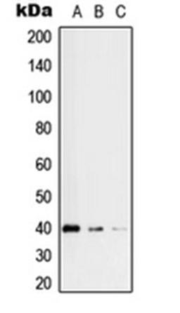 Western blot analysis of HeLa (Lane 1), HEK293 (Lane 2), Jurkat (Lane 3) whole cell lysates using RFC3 antibody