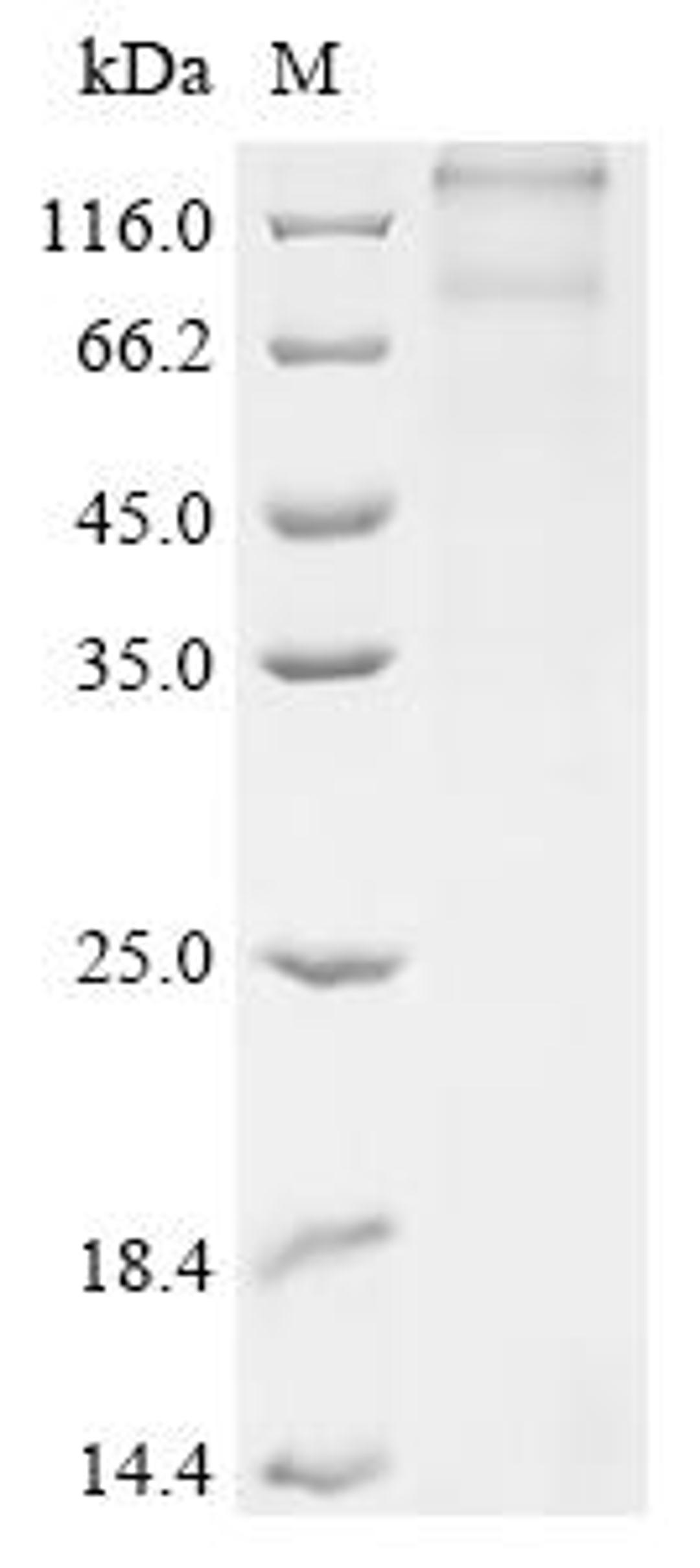 (Tris-Glycine gel) Discontinuous SDS-PAGE (reduced) with 5% enrichment gel and 15% separation gel.