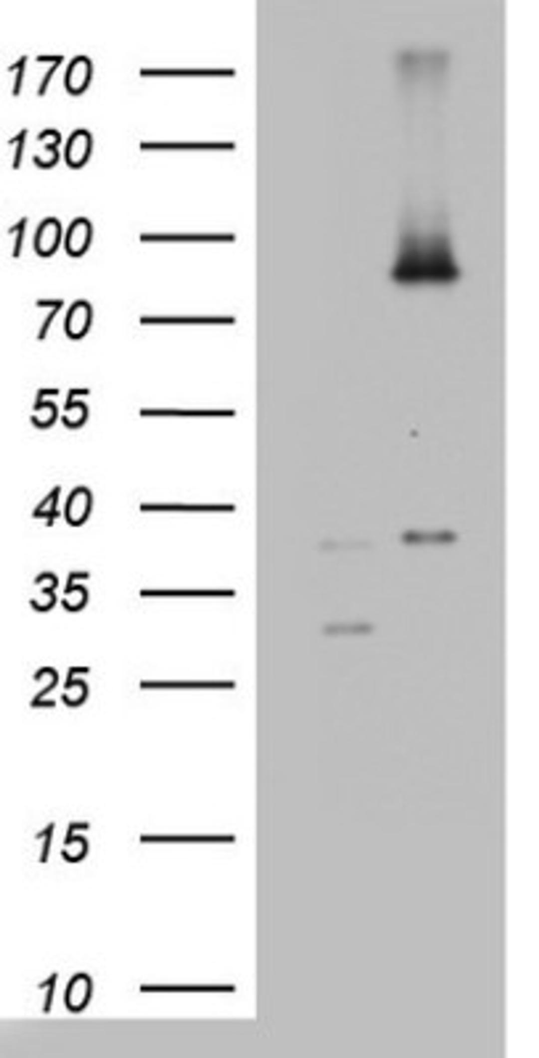 Western Blot: ABCD1 Antibody (2C12) [NBP2-46476] - Analysis of HEK293T cells were transfected with the pCMV6-ENTRY control (Left lane) or pCMV6-ENTRY ABCD1.