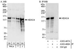 Detection of human HDAC4 by western blot and immunoprecipitation.