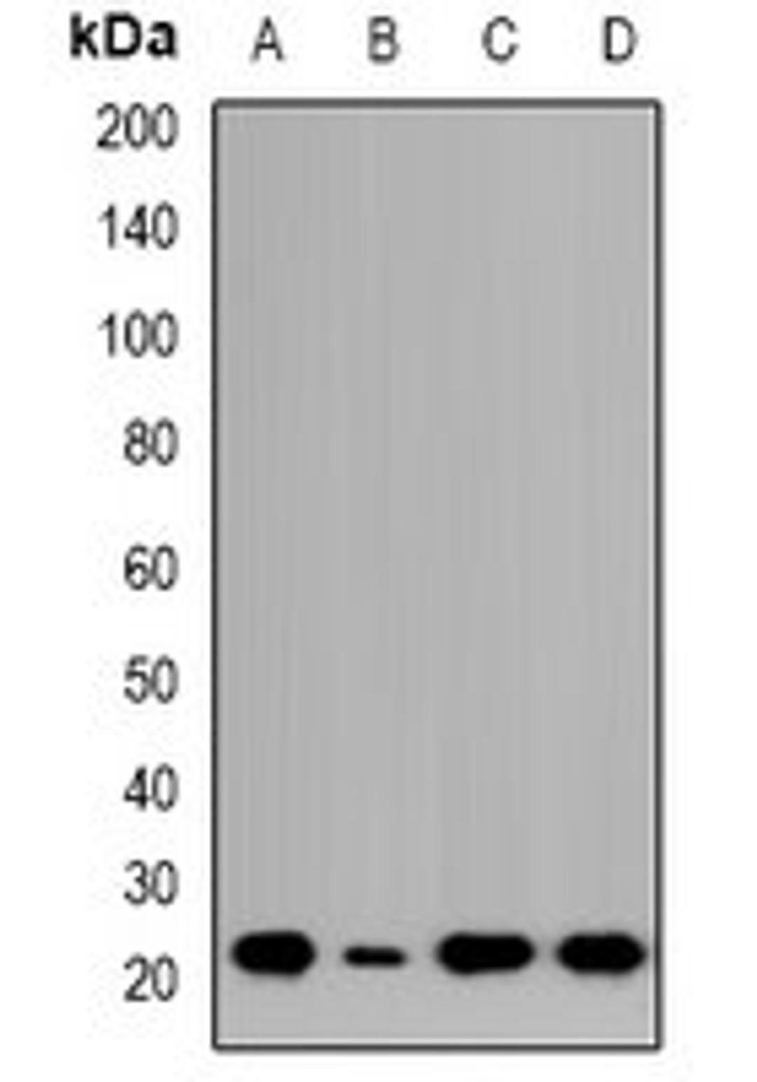 Western blot analysis of HCT116 (Lane1), Jurkat (Lane2), COLO205 (Lane3), LO2 (Lane4) whole cell lysates using NTPCR antibody