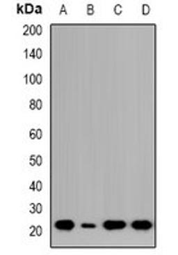 Western blot analysis of HCT116 (Lane1), Jurkat (Lane2), COLO205 (Lane3), LO2 (Lane4) whole cell lysates using NTPCR antibody