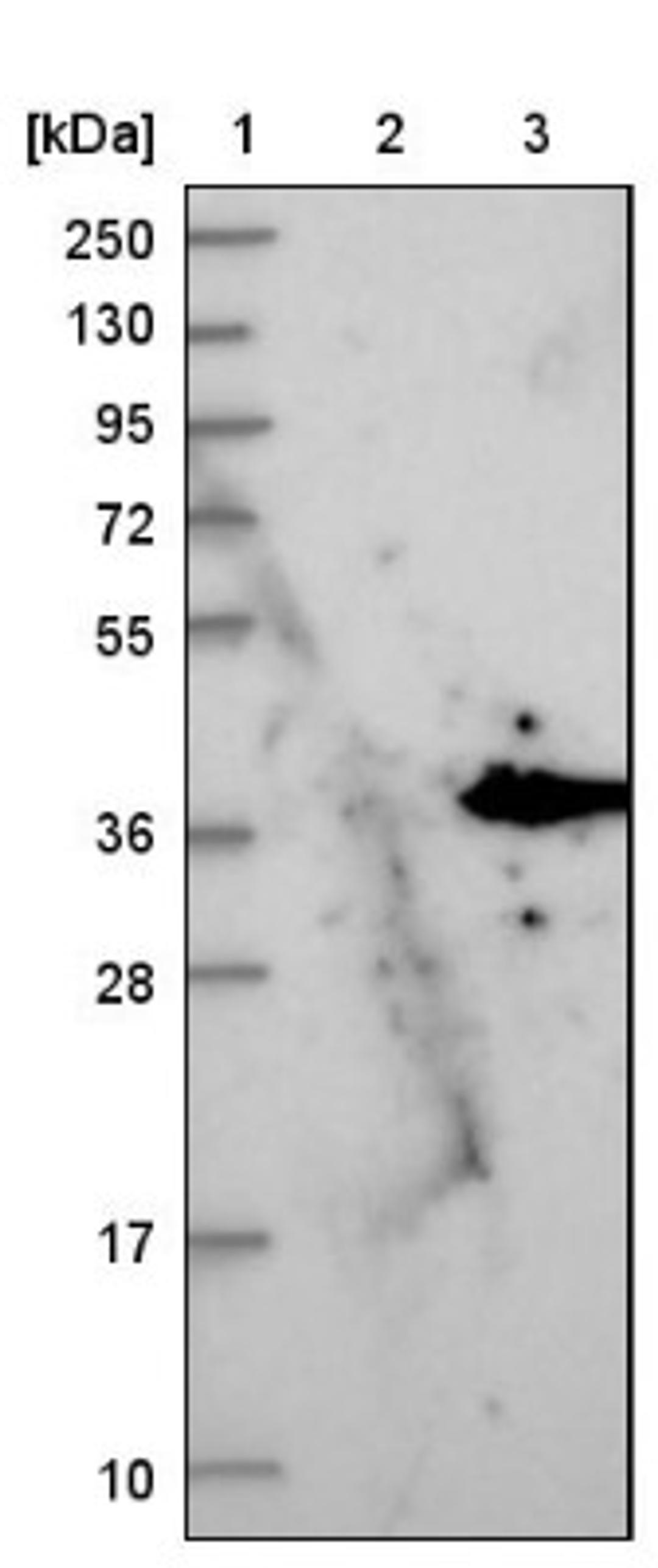 Western Blot: PPP1R3B Antibody [NBP1-82243] - Lane 1: Marker [kDa] 250, 130, 95, 72, 55, 36, 28, 17, 10<br/>Lane 2: Negative control (vector only transfected HEK293T lysate)<br/>Lane 3: Over-expression lysate (Co-expressed with a C-terminal myc-DDK tag (~3.1 kDa) in mammalian HEK293T cells, LY411198)