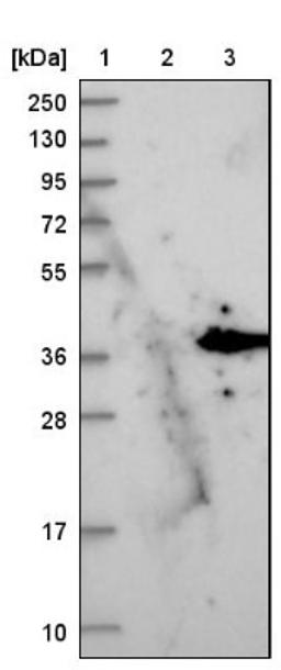 Western Blot: PPP1R3B Antibody [NBP1-82243] - Lane 1: Marker [kDa] 250, 130, 95, 72, 55, 36, 28, 17, 10<br/>Lane 2: Negative control (vector only transfected HEK293T lysate)<br/>Lane 3: Over-expression lysate (Co-expressed with a C-terminal myc-DDK tag (~3.1 kDa) in mammalian HEK293T cells, LY411198)