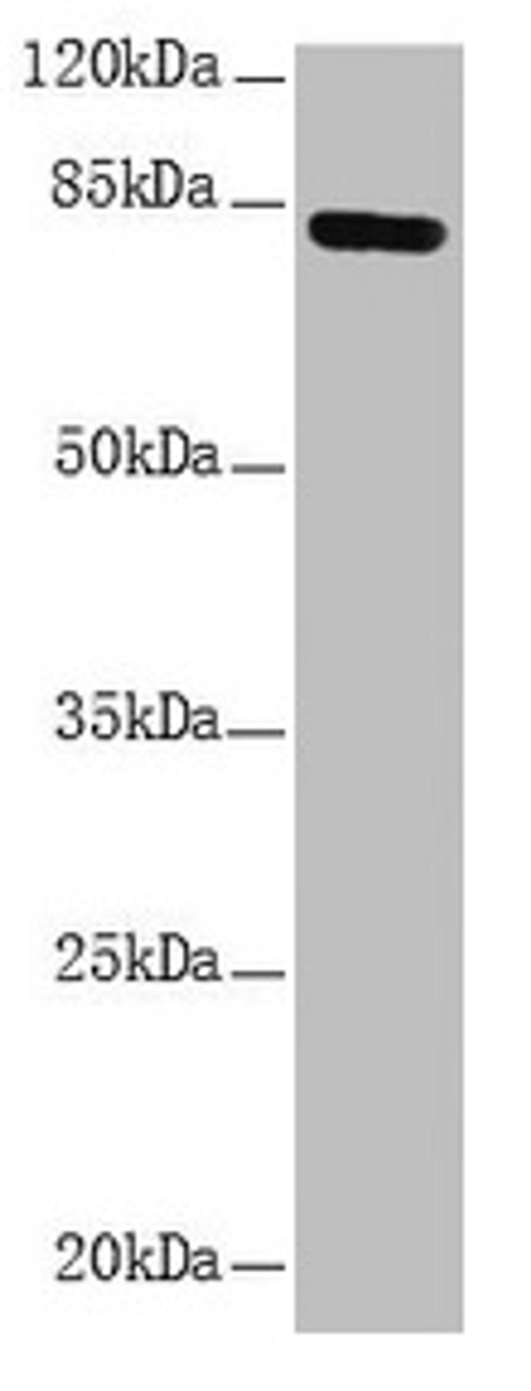 Western blot. All lanes: NDUFS1 antibody at 1.15µg/ml + HepG2 whole cell lysate. Secondary. Goat polyclonal to rabbit IgG at 1/10000 dilution. Predicted band size: 80, 81, 68, 74, 76 kDa. Observed band size: 80 kDa