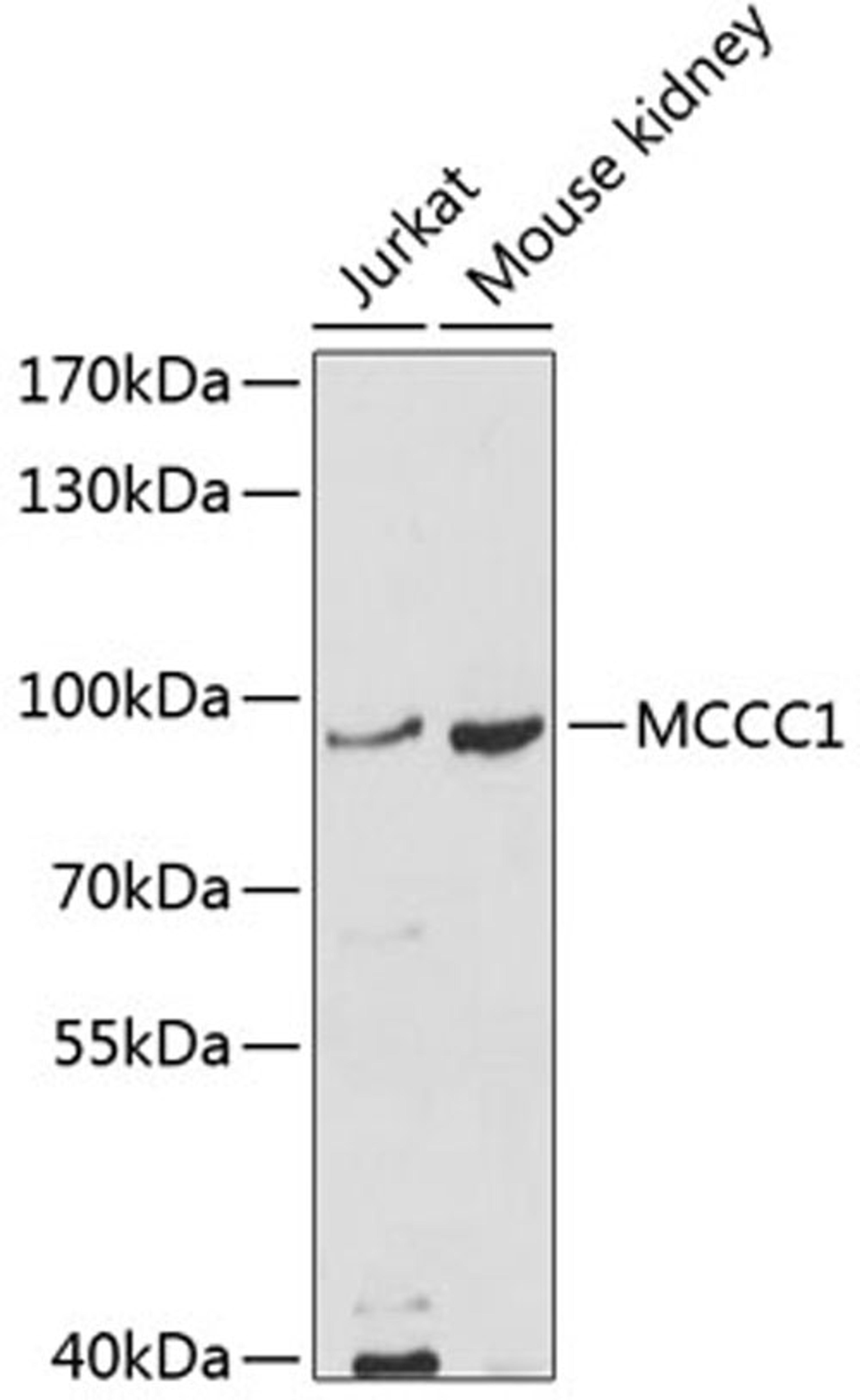 Western blot - MCCC1 antibody (A10020)