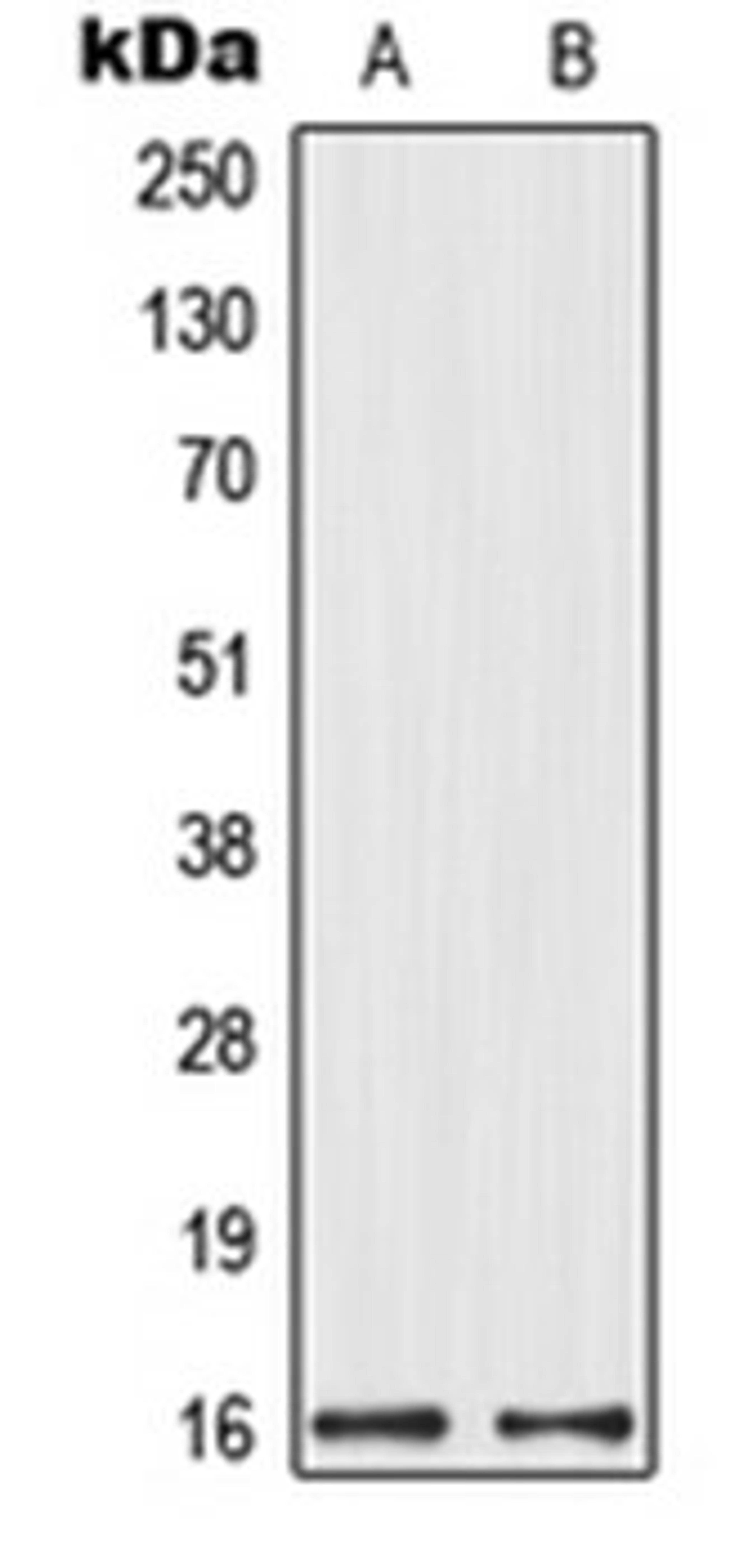 Western blot analysis of HeLa (Lane 1), HEK293 (Lane 2) whole cell lysates using MRPL14 antibody