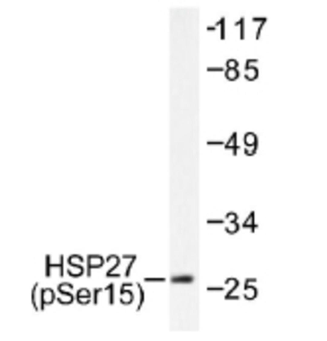 Western Blot: HSP27 Phosphospecific Antibody [NB100-92553] - Western blot (WB) analysis of p-HSP27 (S15) antibody  in extracts from 293 cells treated with UV.