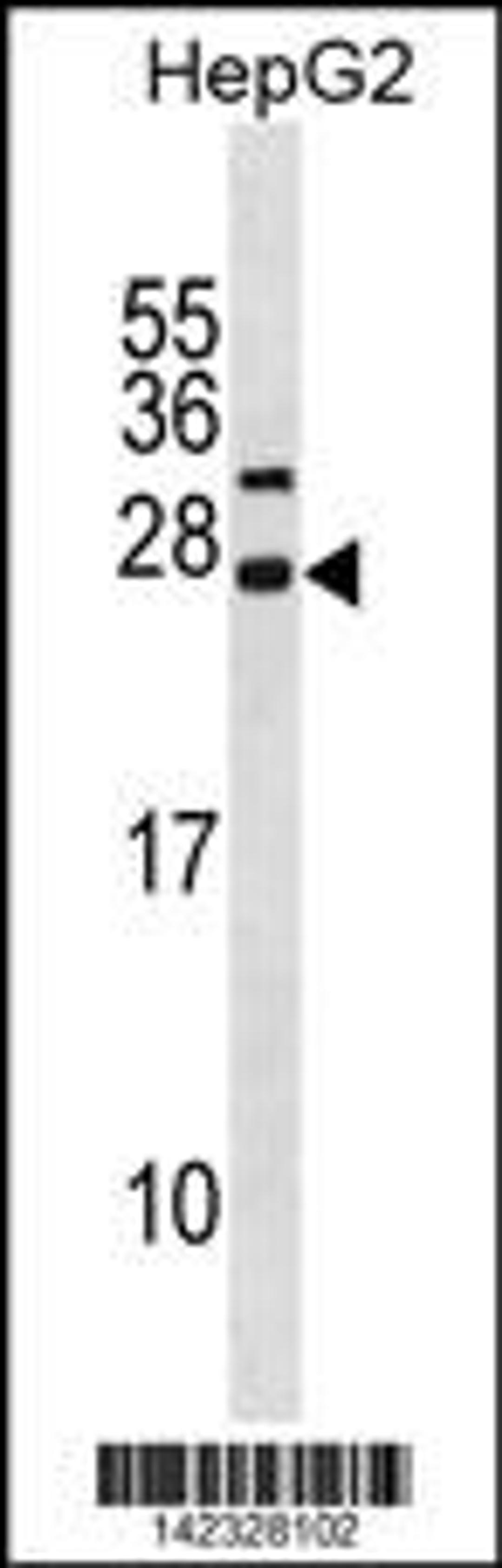 Western blot analysis in HepG2 cell line lysates (35ug/lane).