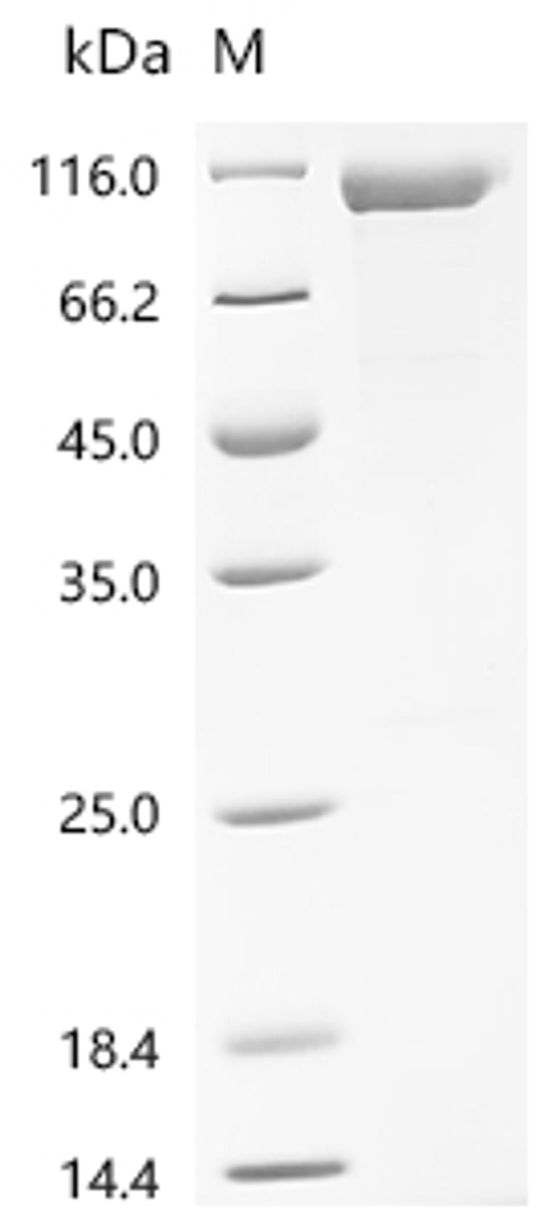 (Tris-Glycine gel) Discontinuous SDS-PAGE (reduced) with 5% enrichment gel and 15% separation gel.