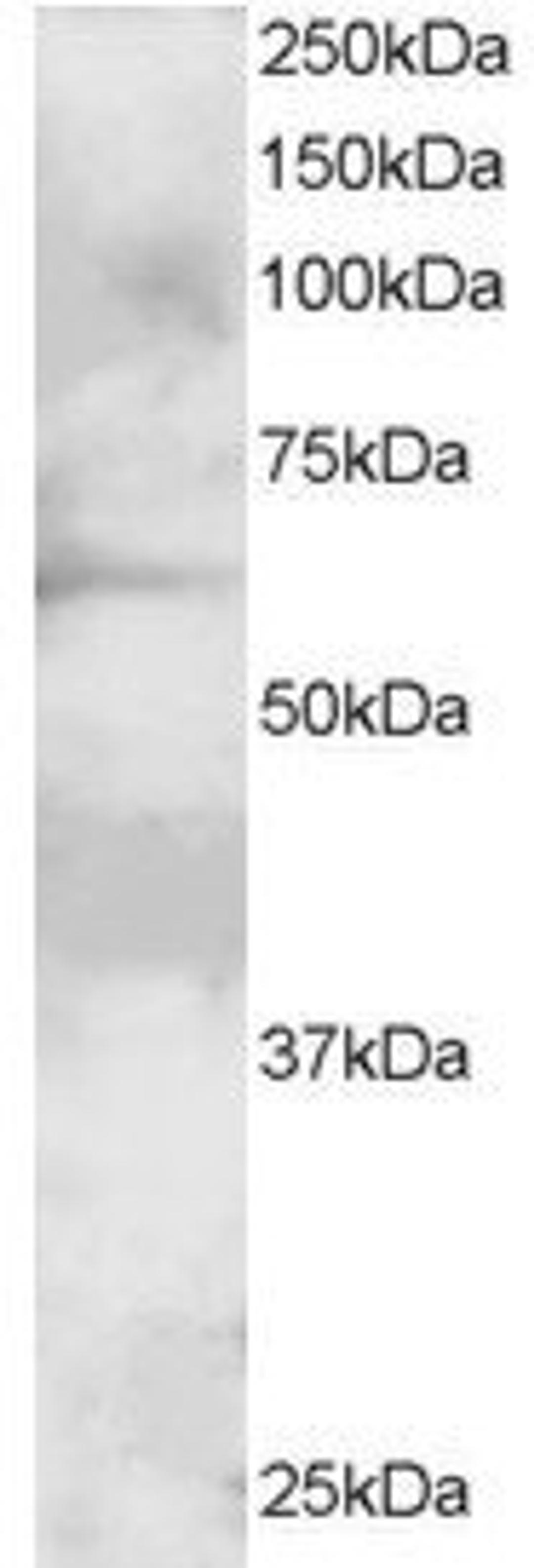 45-707 staining (2ug/ml) of A431 lysate (RIPA buffer, 30ug total protein per lane). Primary incubated for 1 hour. Detected by western blot using chemiluminescence.