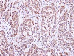 Immunohistochemistry-Paraffin: DGAT2 Antibody [NBP1-33088] - Paraffin-embedded A549 xenograft, using antibody at 1:100 dilution.