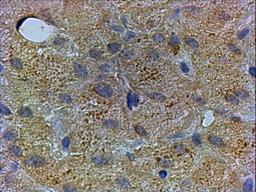 46-170 (xug/ml) staining of paraffin embedded Human Liver. Steamed antigen retrieval with citrate buffer pH 6, HRP-staining.