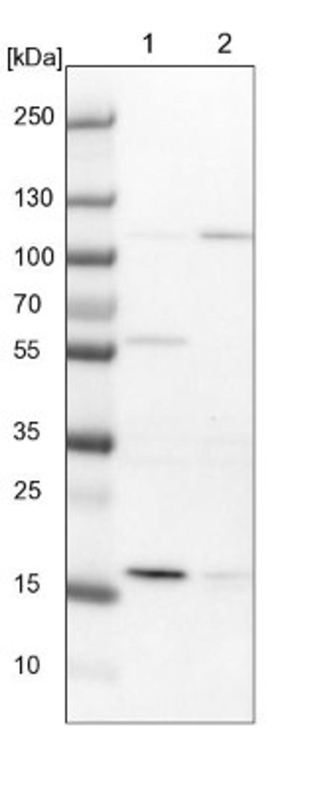 Western Blot: Integrin beta 6 Antibody [NBP2-14136] - Lane 1: NIH-3T3 cell lysate (Mouse embryonic fibroblast cells)<br/>Lane 2: NBT-II cell lysate (Rat Wistar bladder tumour cells)