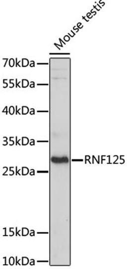 Western blot - RNF125 antibody (A15165)