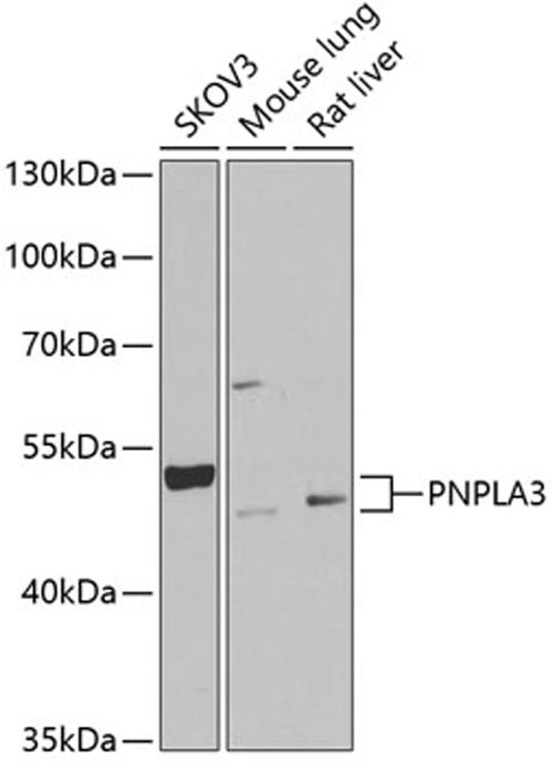 Western blot - PNPLA3 Antibody (A6694)