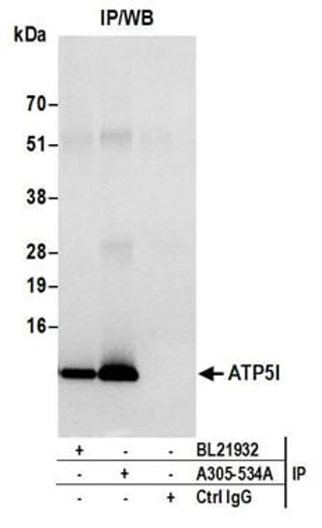 Detection of human ATP5I by western blot of immunoprecipitates.