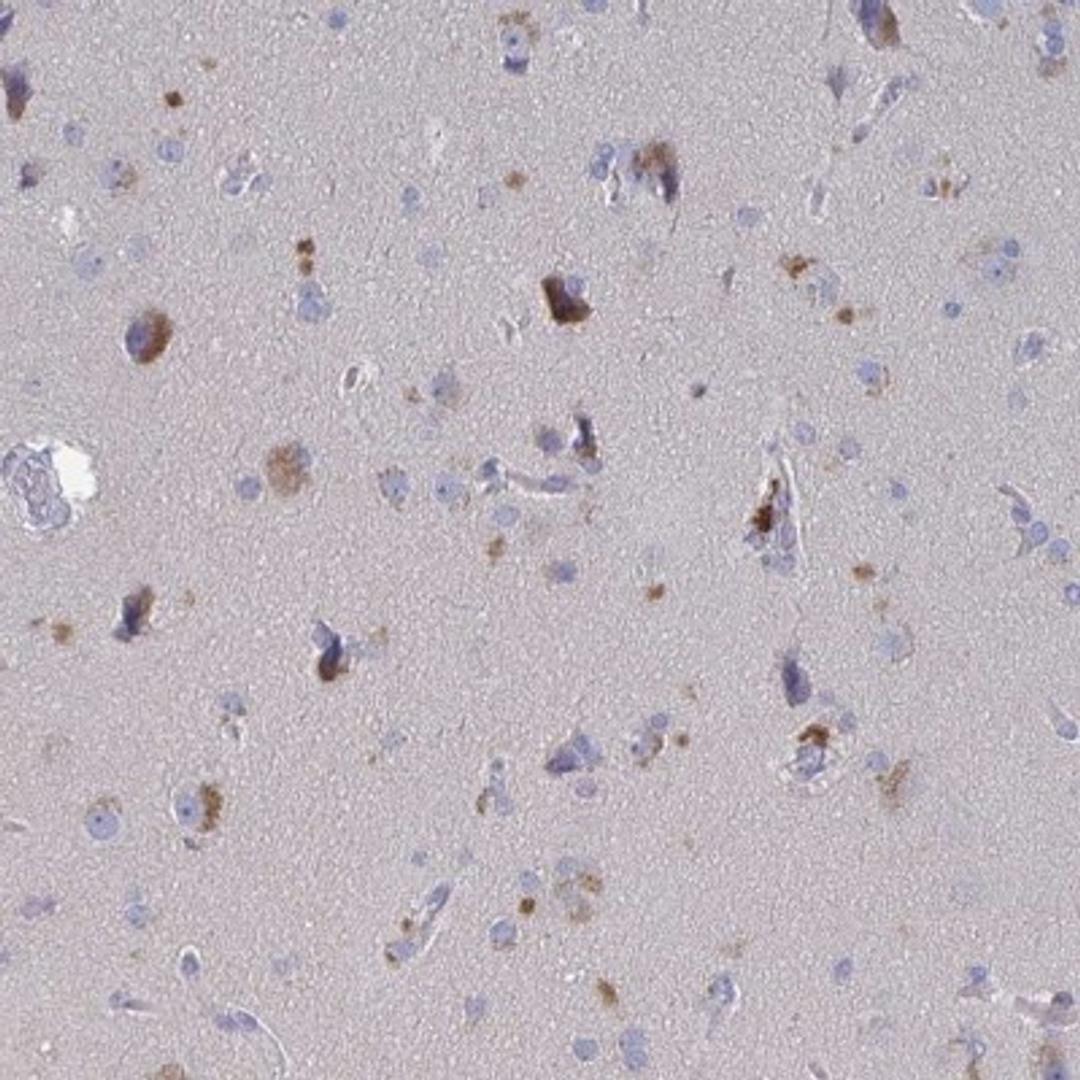 Immunohistochemistry: GPR148 Antibody [NBP2-32550] - Staining of human cerebral cortex shows strong cytoplasmic positivity in neuronal cells.